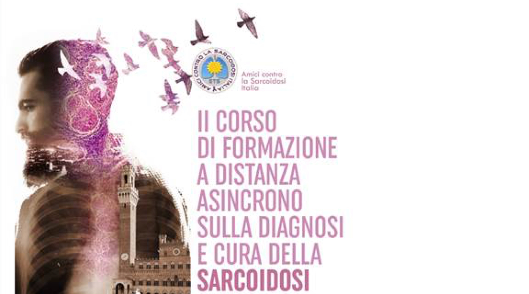 Clicca per accedere all'articolo II Corso di Formazione a distanza asincrono sulla Diagnosi e Cusa della Sarcoidosi