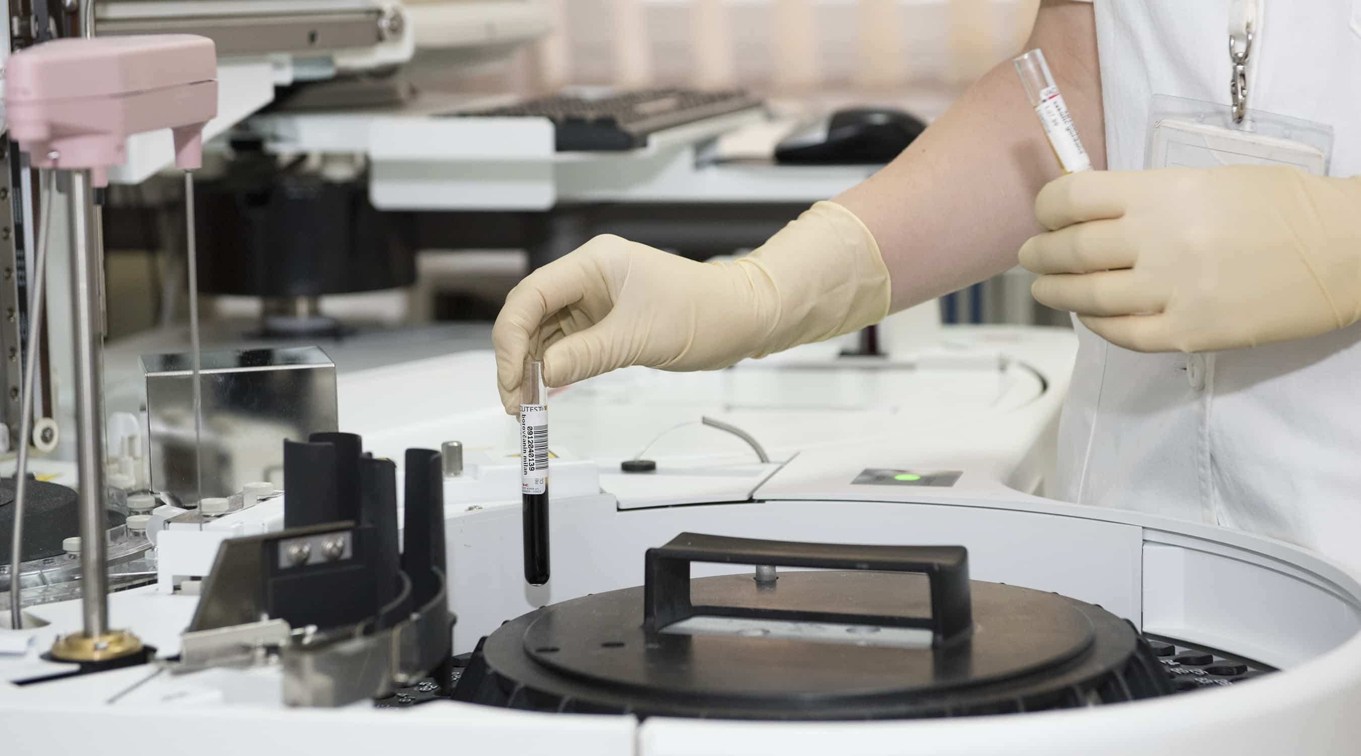 Clicca per accedere all'articolo Hantavirus: indicazioni per la valutazione e gestione dei casi sospetti, probabili e confermati - La Circolare